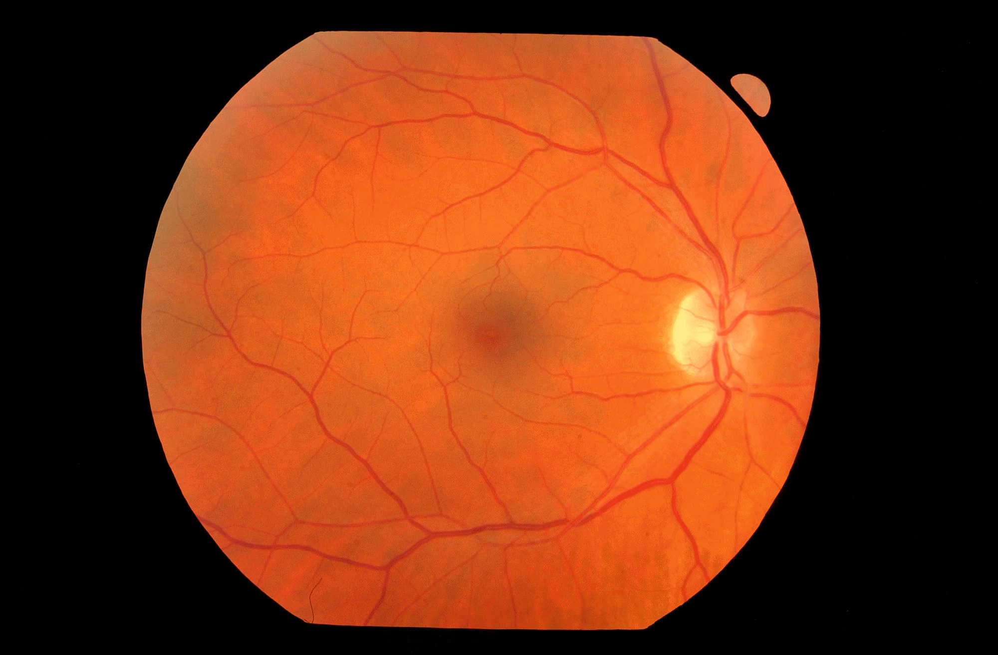 Eye care illustration